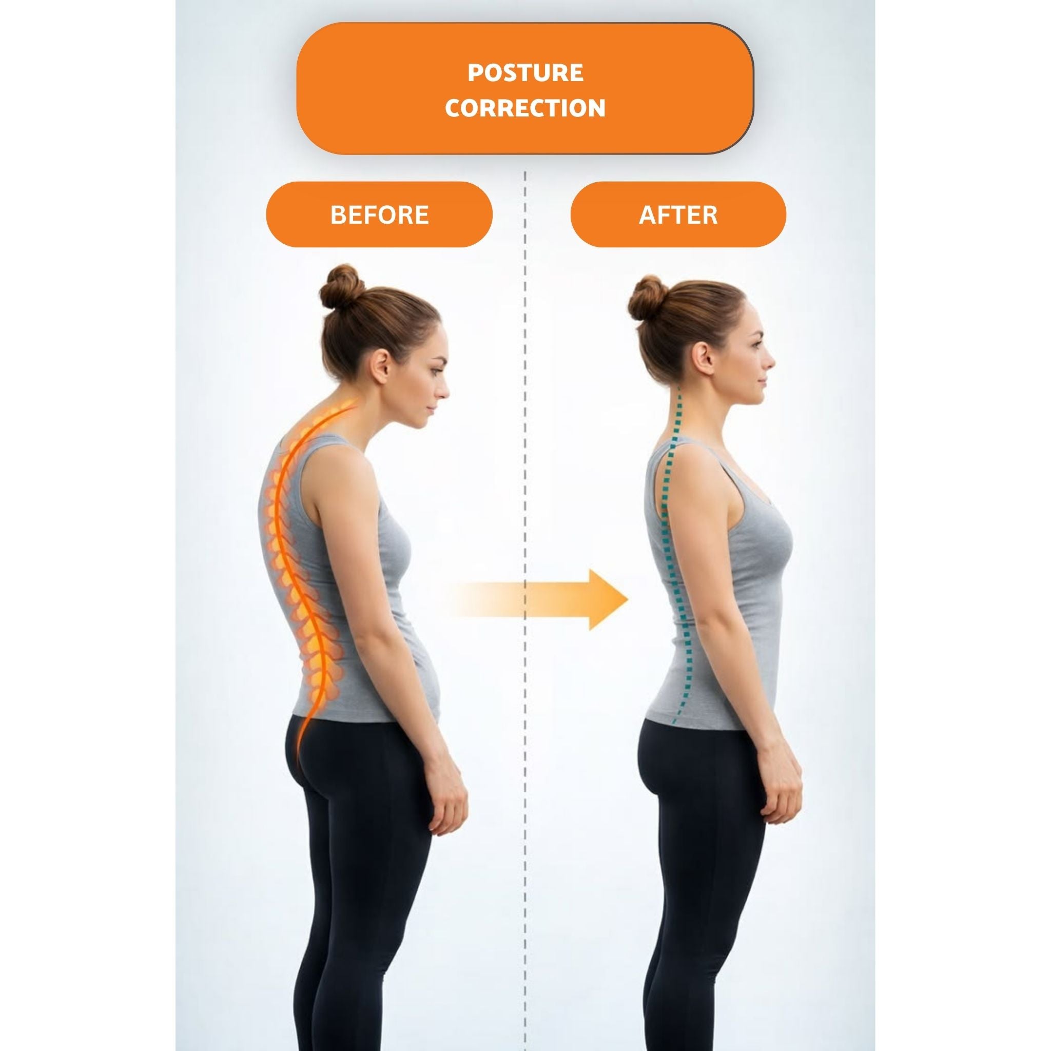 Adjustable Men And Women Posture Corrector